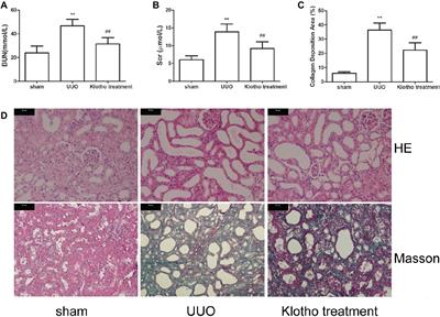 Klotho Inhibits Unilateral Ureteral Obstruction-Induced Endothelial-to-Mesenchymal Transition via TGF-β1/Smad2/Snail1 Signaling in Mice